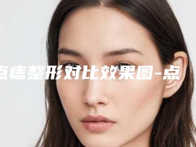 点痣整形对比效果图-点痣后效果要如何保持长久