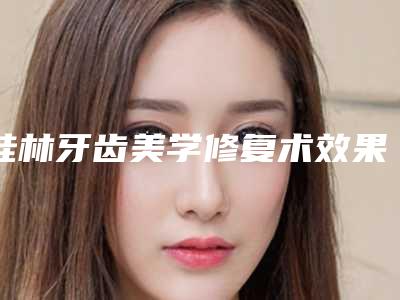 桂林牙齿美学修复术效果好不好价格是多少