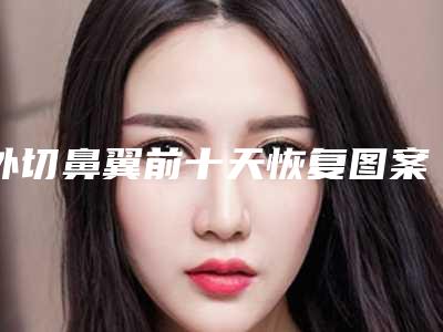 外切鼻翼前十天恢复图案例，提高颜值从鼻子开始