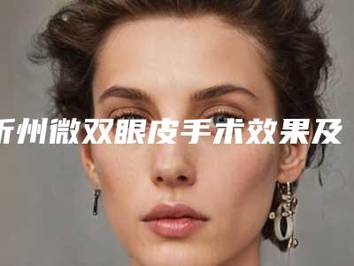 忻州微双眼皮手术效果及术后护理