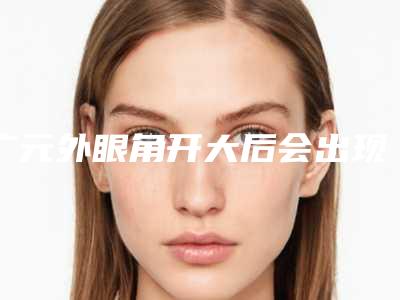 广元外眼角开大后会出现后遗症吗