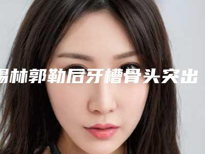 锡林郭勒后牙槽骨头突出修复手术的安全性如何